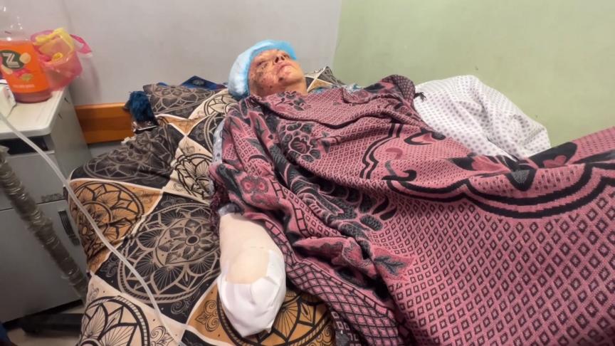 Gazze'de sahile giden 70 yaşındaki kadın İsrail saldırısında elini kaybetti