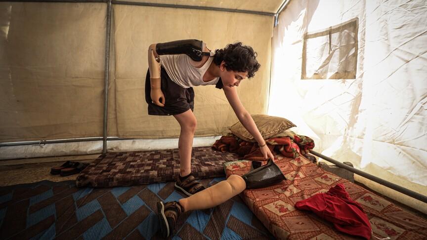 Gazze'de 5 bin kişi uzuv kaybetti, 10 bin hasta rehabilitasyon bekliyor