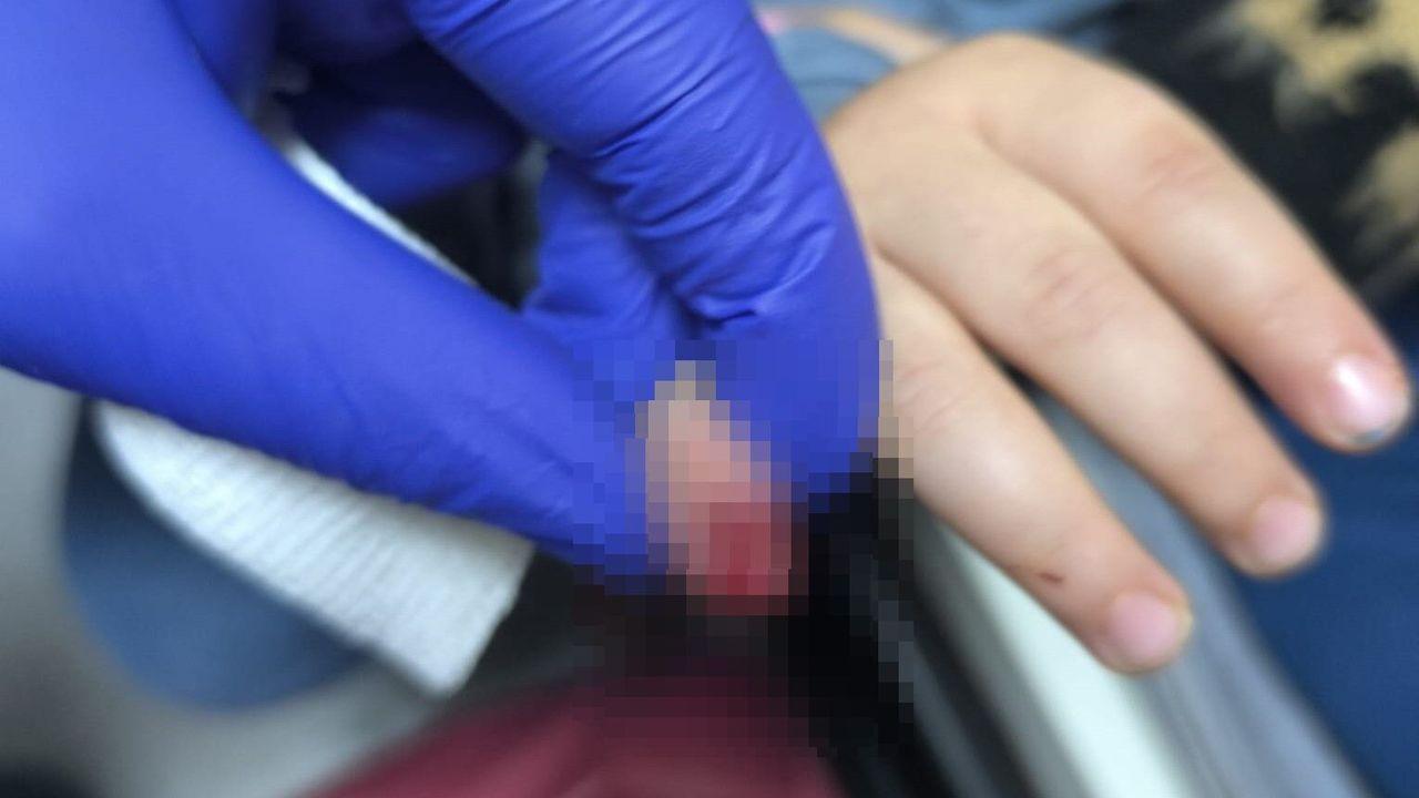 Yürüyen merdivene eli sıkışan çocuğun kopan parmağı kurtarılamadı